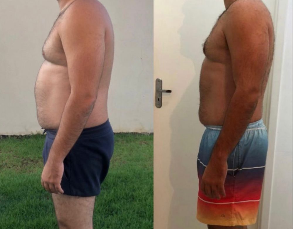 Antes e depois DU Antes e depois DU